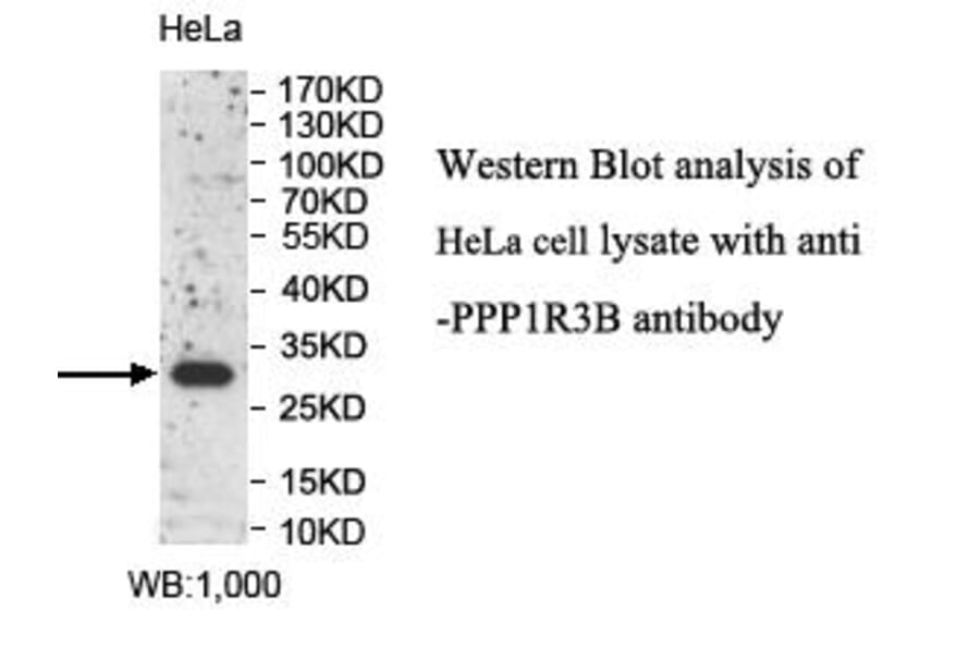 PPP1R3B Antibody from Signalway Antibody (39992) - Antibodies.com