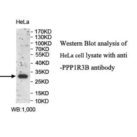 PPP1R3B Antibody from Signalway Antibody (39992) - Antibodies.com