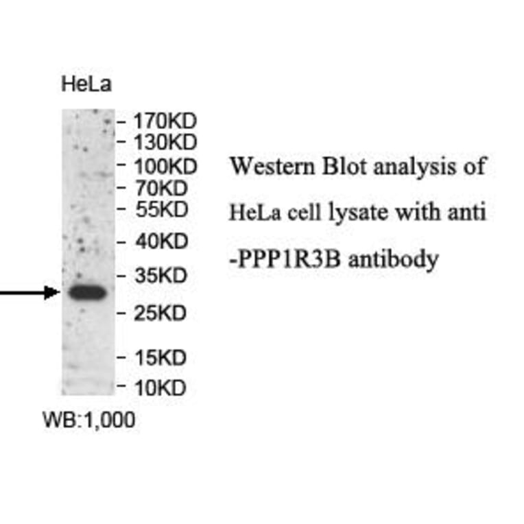 PPP1R3B Antibody from Signalway Antibody (39992) - Antibodies.com