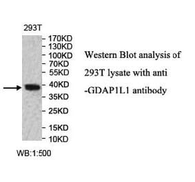 GDAP1L1 Antibody from Signalway Antibody (40004) - Antibodies.com
