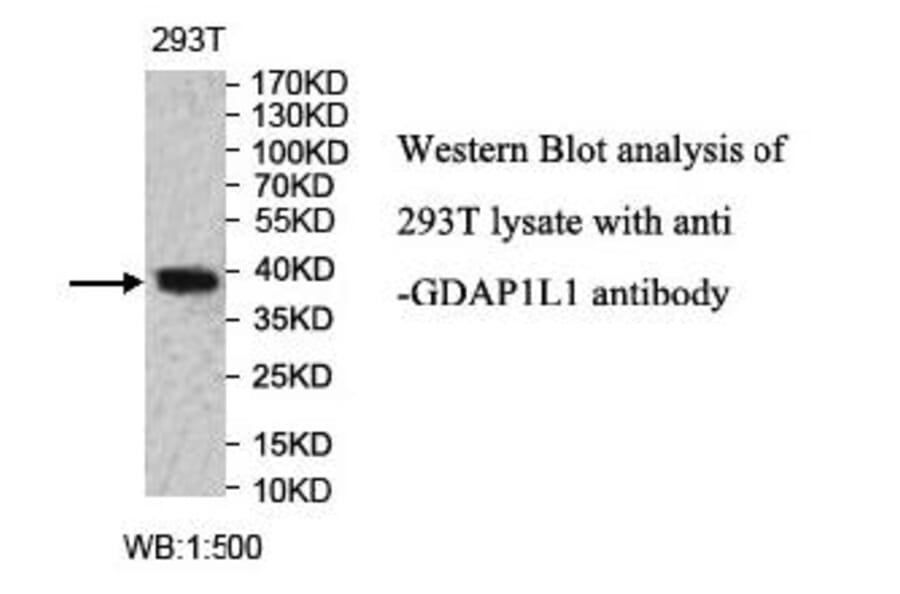 GDAP1L1 Antibody from Signalway Antibody (40004) - Antibodies.com