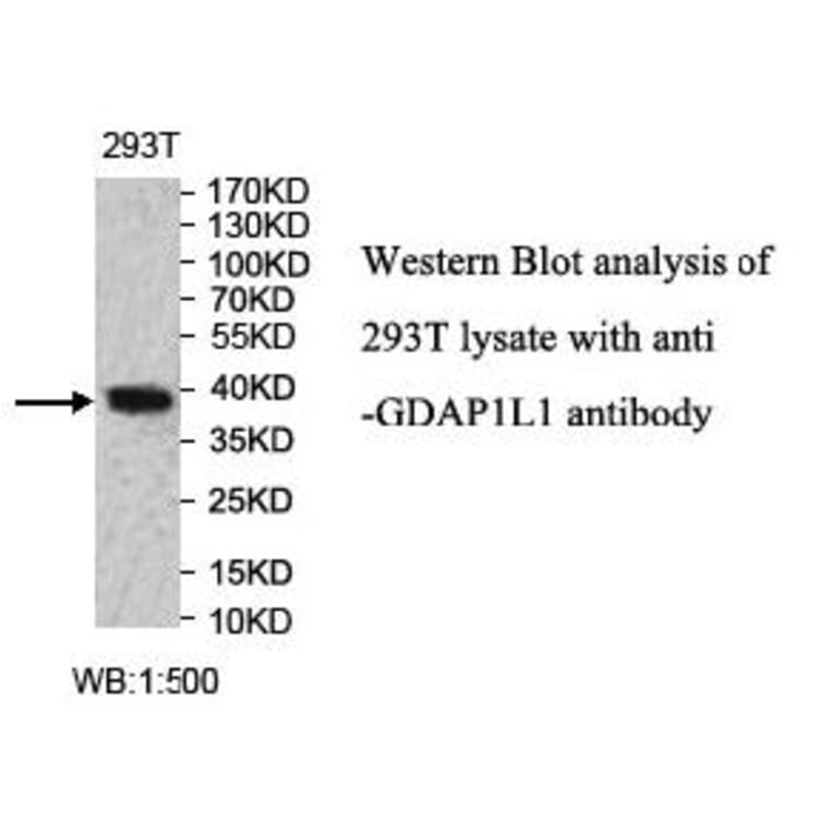 GDAP1L1 Antibody from Signalway Antibody (40004) - Antibodies.com