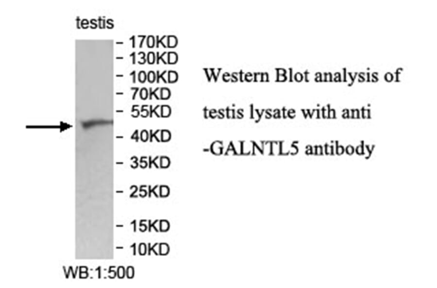 GALNTL5 Antibody from Signalway Antibody (40028) - Antibodies.com