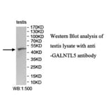 GALNTL5 Antibody from Signalway Antibody (40028) - Antibodies.com