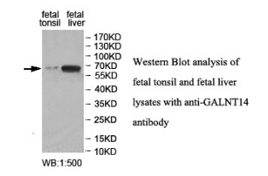 GALNT14 Antibody from Signalway Antibody (40030) - Antibodies.com