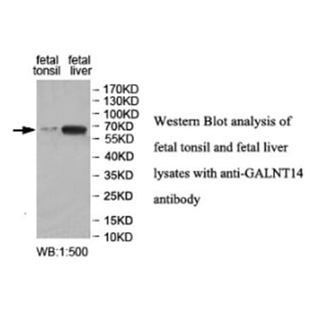 GALNT14 Antibody from Signalway Antibody (40030) - Antibodies.com