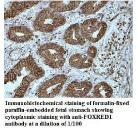 FOXRED1 Antibody from Signalway Antibody (40036) - Antibodies.com