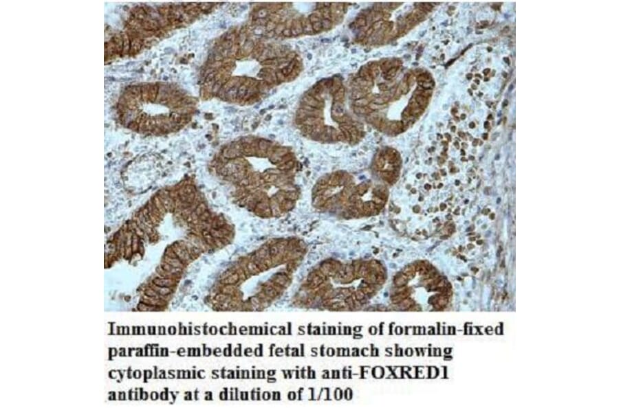 FOXRED1 Antibody from Signalway Antibody (40036) - Antibodies.com