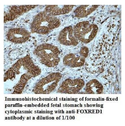 FOXRED1 Antibody from Signalway Antibody (40036) - Antibodies.com