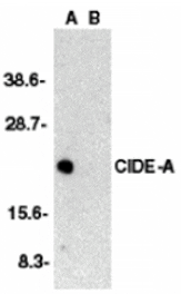Western blot - CIDE-A Antibody from Signalway Antibody (24053) - Antibodies.com