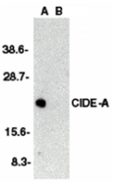 Western blot - CIDE-A Antibody from Signalway Antibody (24053) - Antibodies.com