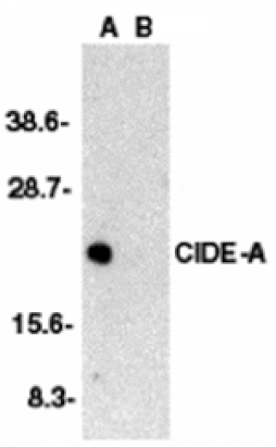 Western blot - CIDE-A Antibody from Signalway Antibody (24053) - Antibodies.com