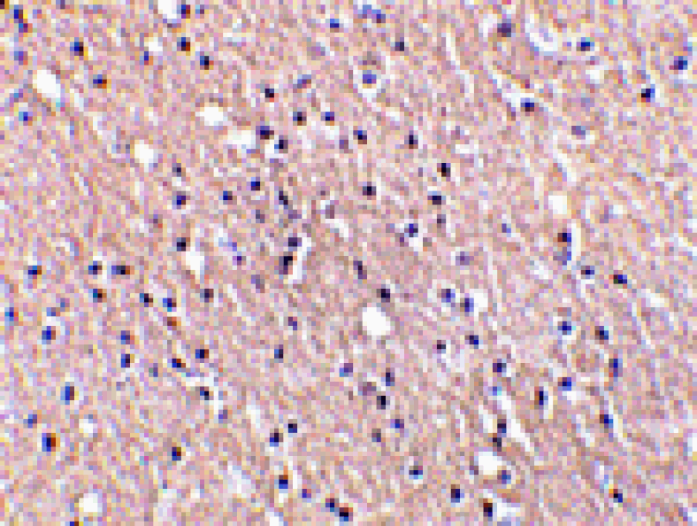 Immunohistochemistry - CIDE-A Antibody from Signalway Antibody (24053) - Antibodies.com