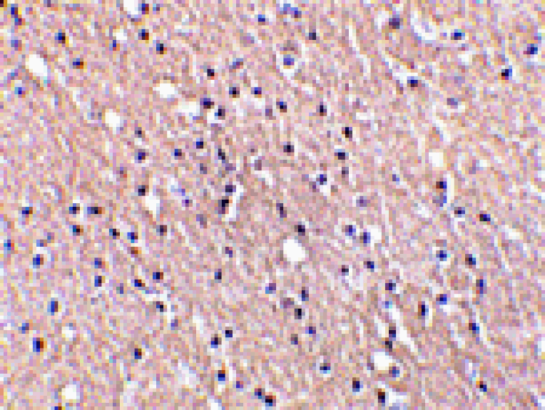Immunohistochemistry - CIDE-A Antibody from Signalway Antibody (24053) - Antibodies.com