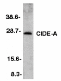 Western blot - CIDE-A Antibody from Signalway Antibody (24054) - Antibodies.com