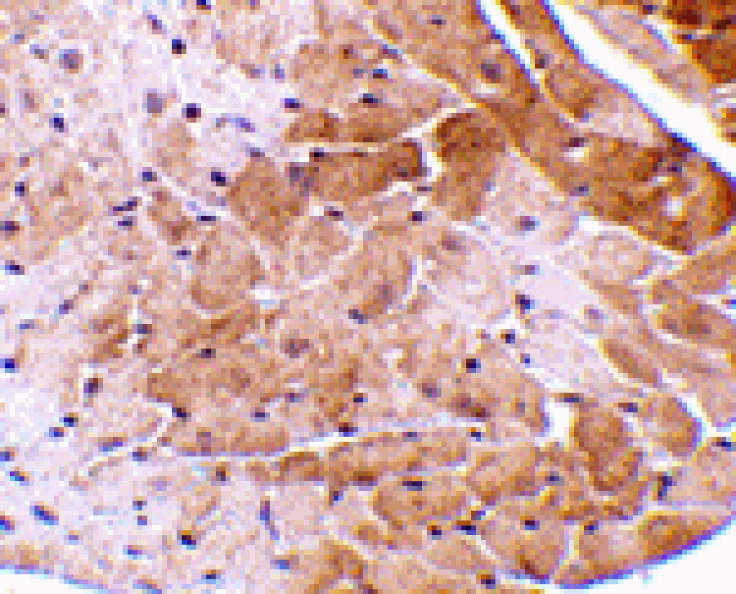 Immunohistochemistry - CIDE-A Antibody from Signalway Antibody (24054) - Antibodies.com