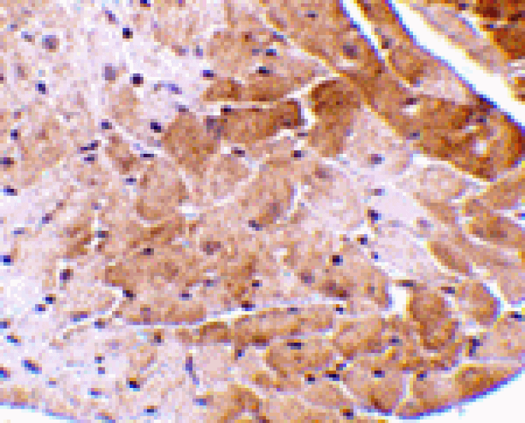 Immunohistochemistry - CIDE-A Antibody from Signalway Antibody (24054) - Antibodies.com