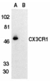 Western blot - CX3CR1 Antibody from Signalway Antibody (24082) - Antibodies.com