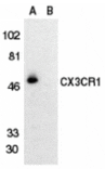Western blot - CX3CR1 Antibody from Signalway Antibody (24082) - Antibodies.com