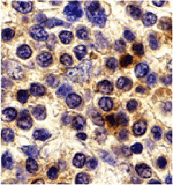 Immunohistochemistry - CX3CR1 Antibody from Signalway Antibody (24082) - Antibodies.com