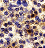 Immunohistochemistry - CX3CR1 Antibody from Signalway Antibody (24082) - Antibodies.com