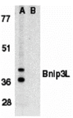 Western blot - Bnip3L Antibody from Signalway Antibody (24112) - Antibodies.com