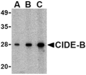 Western blot - CIDE-B Antibody from Signalway Antibody (24116) - Antibodies.com
