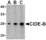 Western blot - CIDE-B Antibody from Signalway Antibody (24116) - Antibodies.com