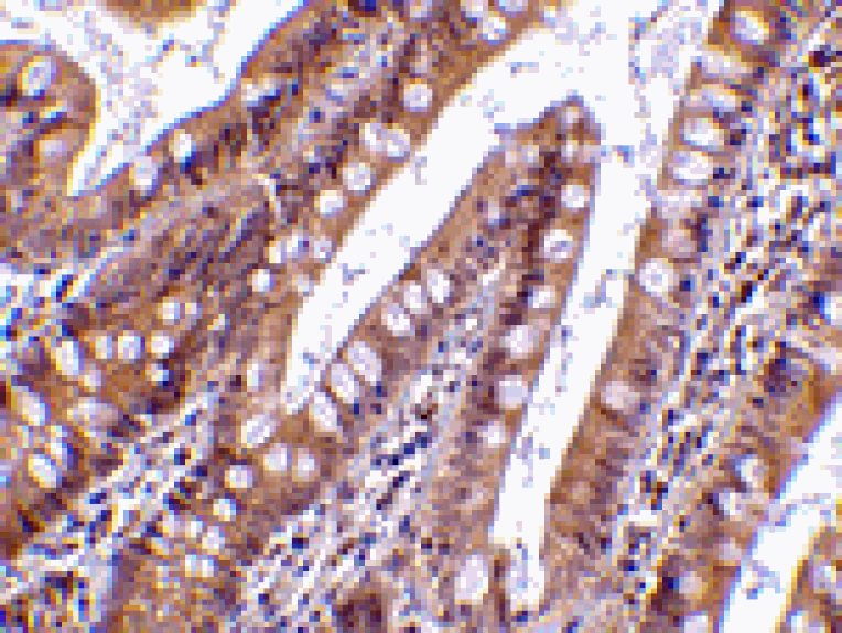 Immunohistochemistry - CIDE-B Antibody from Signalway Antibody (24116) - Antibodies.com