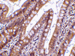 Immunohistochemistry - CIDE-B Antibody from Signalway Antibody (24116) - Antibodies.com