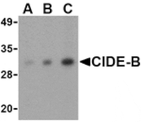 Western blot - CIDE-B Antibody from Signalway Antibody (24117) - Antibodies.com
