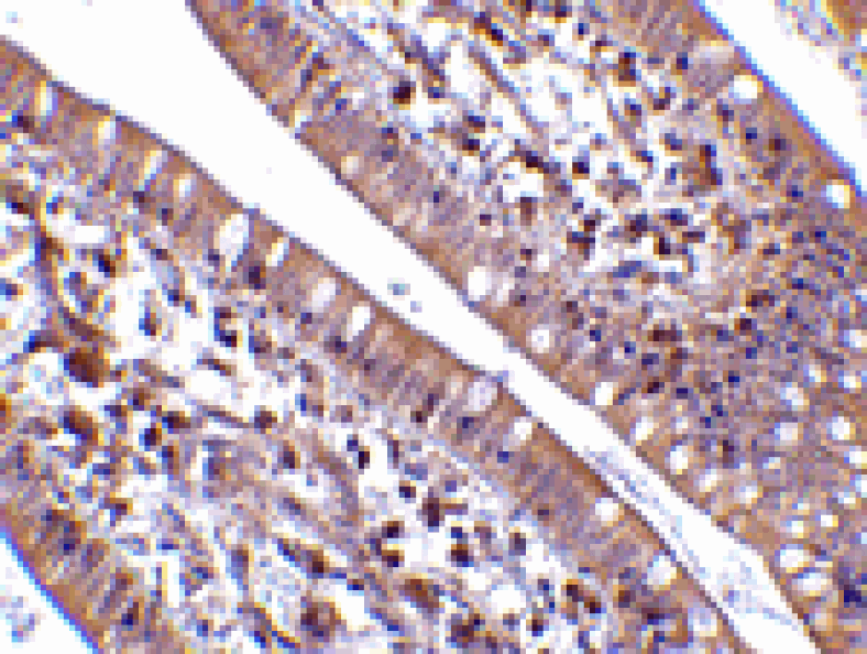 Immunohistochemistry - CIDE-B Antibody from Signalway Antibody (24117) - Antibodies.com