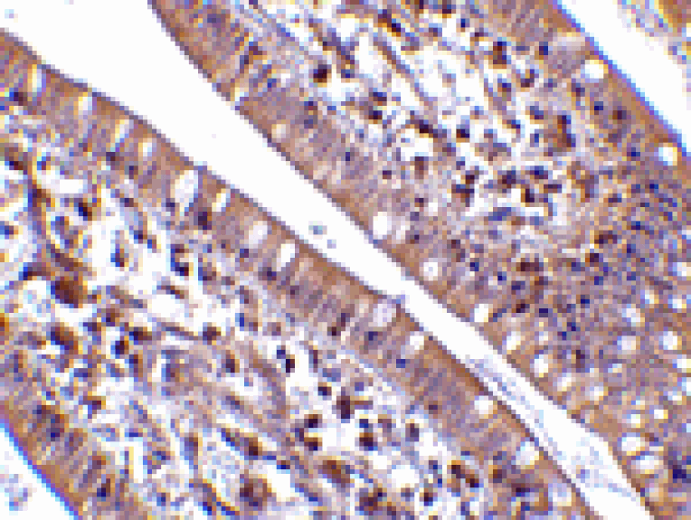 Immunohistochemistry - CIDE-B Antibody from Signalway Antibody (24117) - Antibodies.com