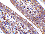 Immunohistochemistry - CIDE-B Antibody from Signalway Antibody (24117) - Antibodies.com