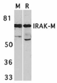 Western blot - IRAK-M Antibody from Signalway Antibody (24128) - Antibodies.com