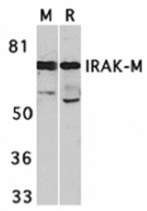 Western blot - IRAK-M Antibody from Signalway Antibody (24128) - Antibodies.com