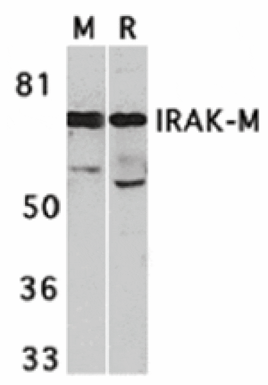 Western blot - IRAK-M Antibody from Signalway Antibody (24128) - Antibodies.com