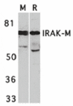 Western blot - IRAK-M Antibody from Signalway Antibody (24128) - Antibodies.com