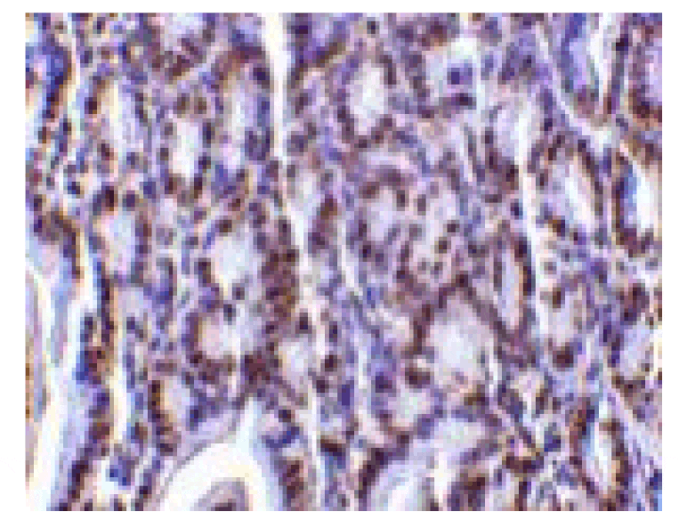 Immunohistochemistry - PHAP I Antibody from Signalway Antibody (24198) - Antibodies.com