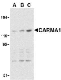 Western blot - CARMA1 Antibody from Signalway Antibody (24207) - Antibodies.com
