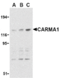 Western blot - CARMA1 Antibody from Signalway Antibody (24207) - Antibodies.com
