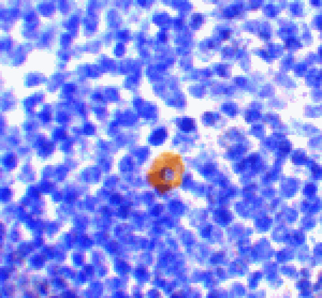 Immunohistochemistry - CARMA1 Antibody from Signalway Antibody (24207) - Antibodies.com