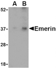 Western blot - Emerin Antibody from Signalway Antibody (24491) - Antibodies.com