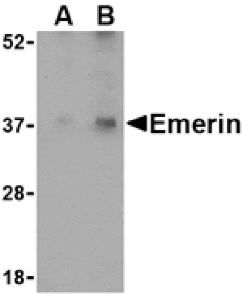 Western blot - Emerin Antibody from Signalway Antibody (24491) - Antibodies.com