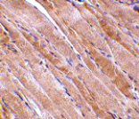 Immunohistochemistry - Emerin Antibody from Signalway Antibody (24491) - Antibodies.com