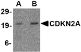 Western blot - CDKN2A Antibody from Signalway Antibody (24530) - Antibodies.com