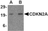 Western blot - CDKN2A Antibody from Signalway Antibody (24530) - Antibodies.com