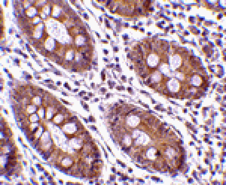 Immunohistochemistry - CDKN2A Antibody from Signalway Antibody (24530) - Antibodies.com