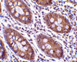 Immunohistochemistry - CDKN2A Antibody from Signalway Antibody (24530) - Antibodies.com