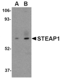 Western blot - STEAP1 Antibody from Signalway Antibody (24565) - Antibodies.com